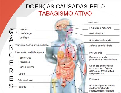 Perguntas em tabeks